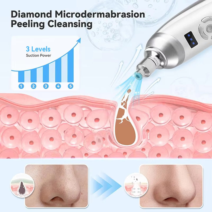 4Pcs Tips Portable Diamond Microdermabrasion Machine for anti Aging Blackhead Remover Exfoliator for Acne Scars